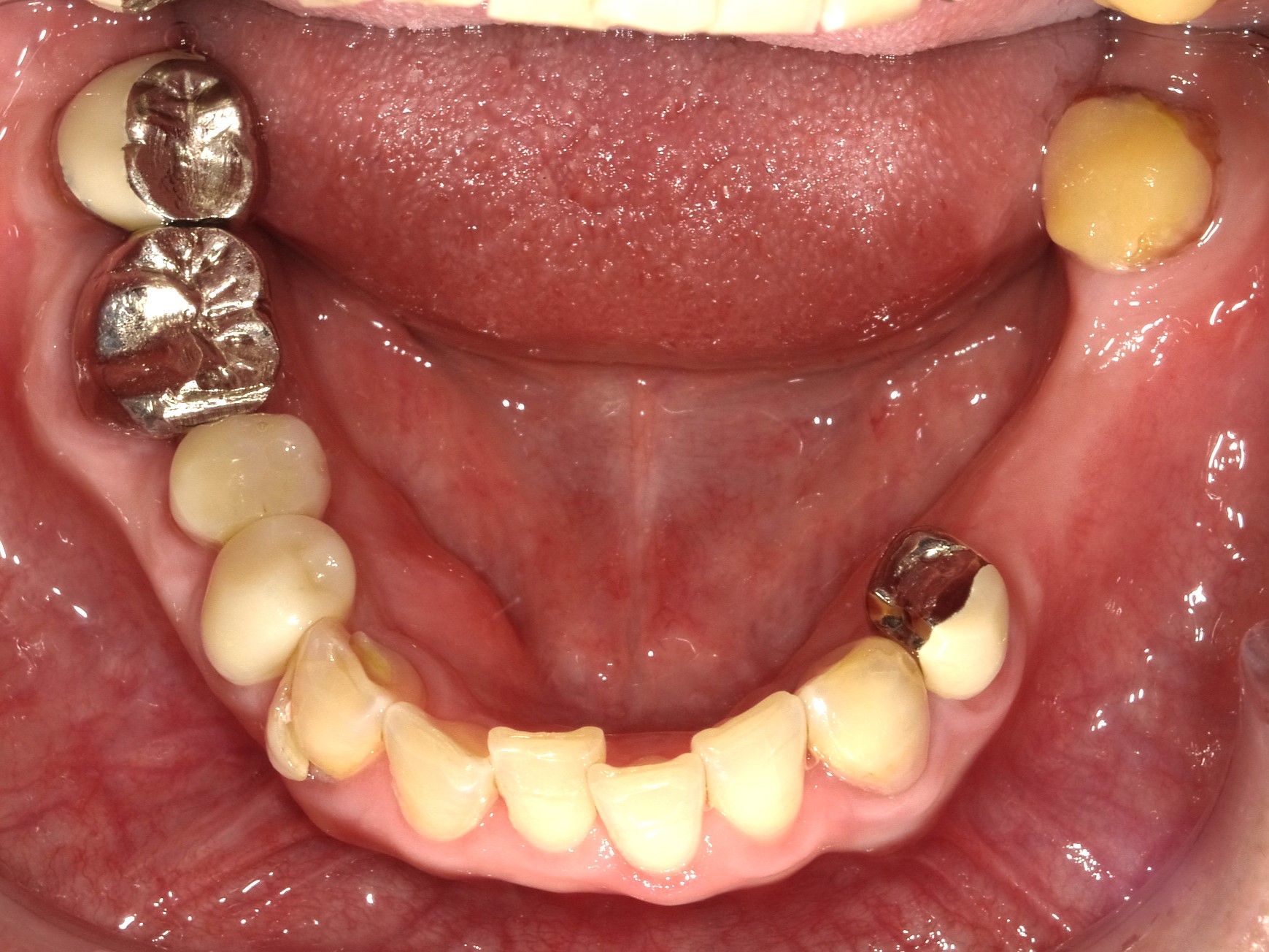 Before