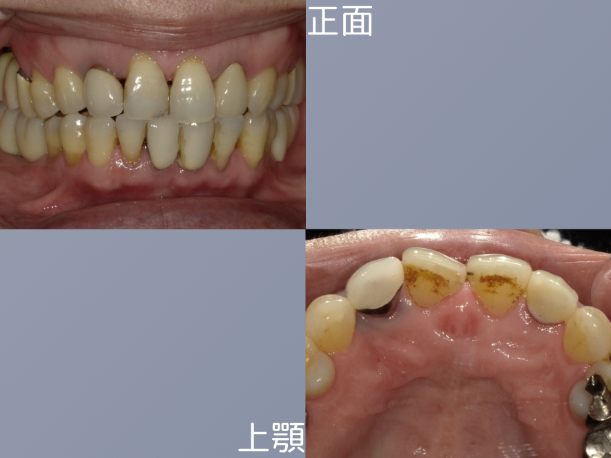 Before