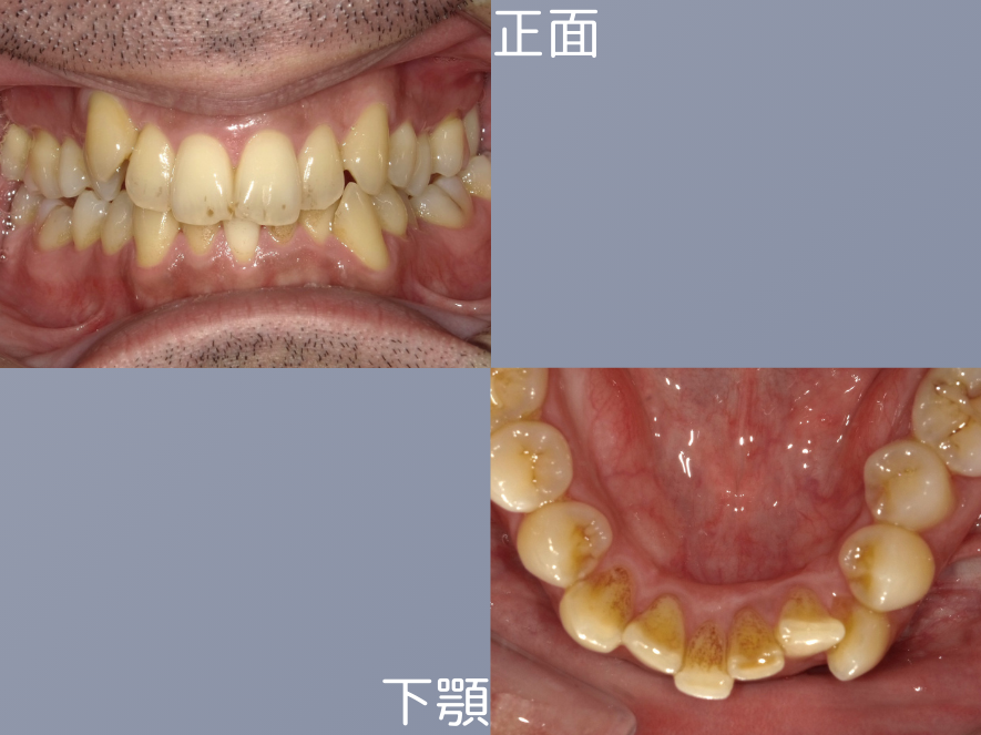 Before