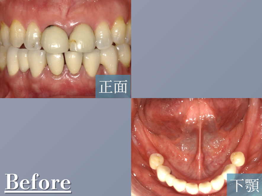 Before