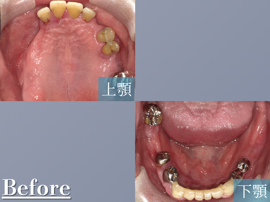 Before