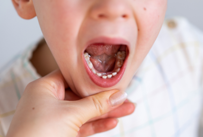 子供の歯