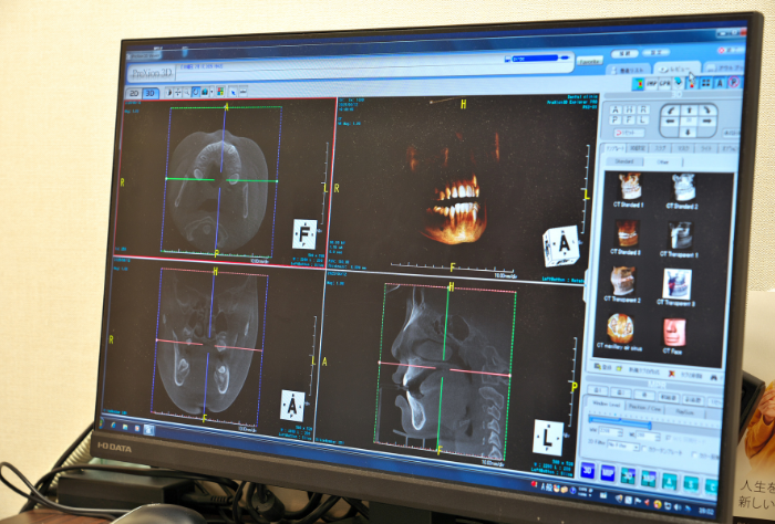 カウンセリング