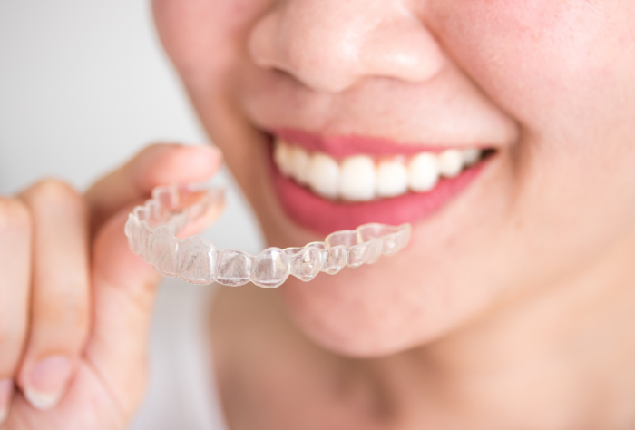 マウスピース矯正