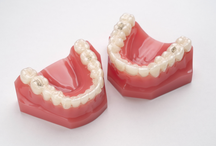 マウスピース矯正のイメージ