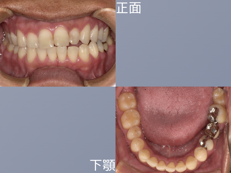 Before